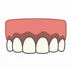 Types of Cosmetic Gum Procedures