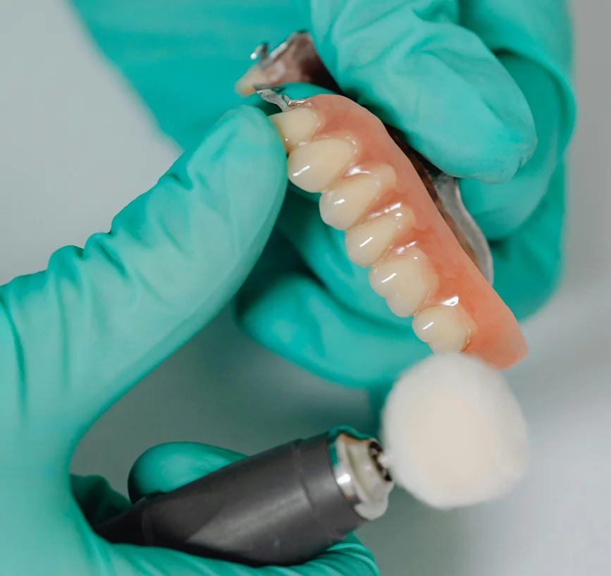 Benefits of Dentures