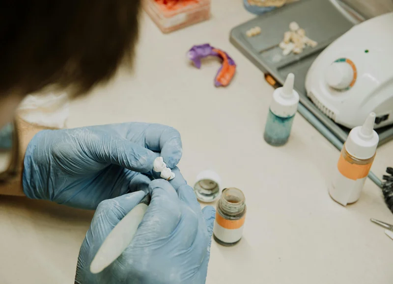 Let’s take through the procedure for Veneers and Laminates