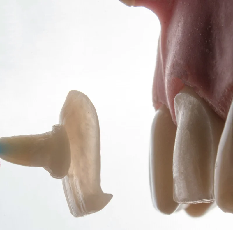 Which One Do You Need