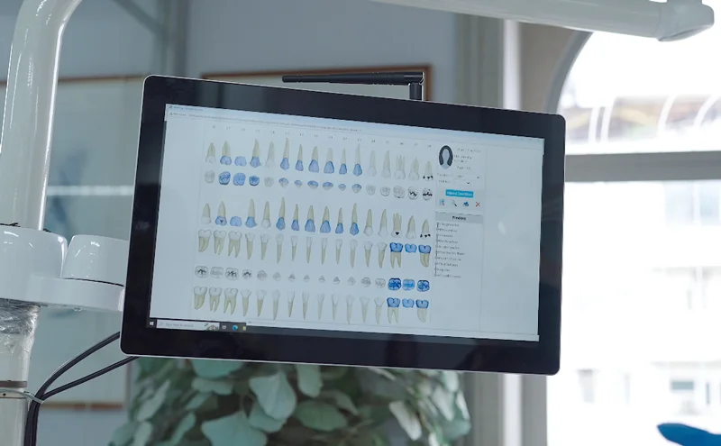3D Charting of Patient Records