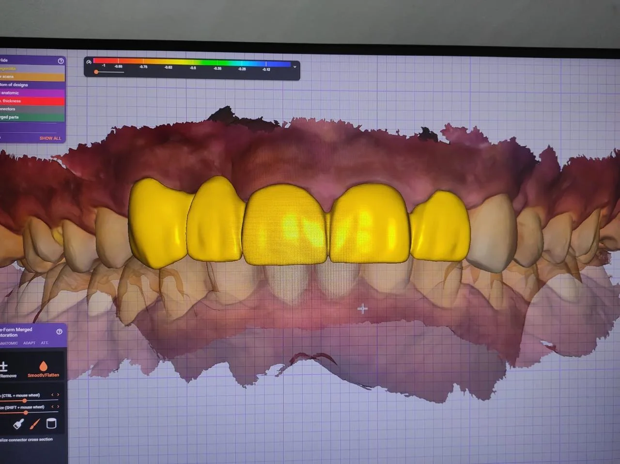 In - House 3D Priniting and CAD/CAM Designing Laboratory